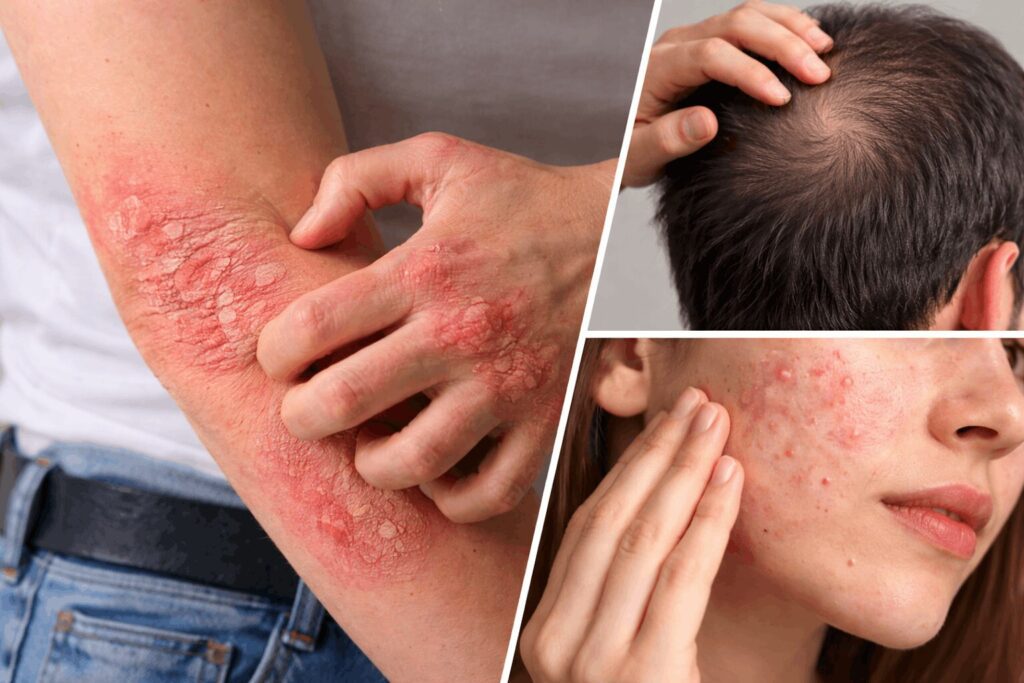Skin & Hair Issues