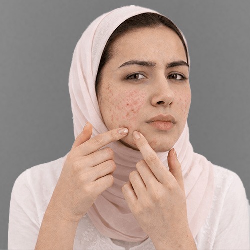Skin Care